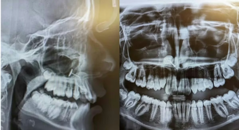 Screenshot_20250819-074452~2