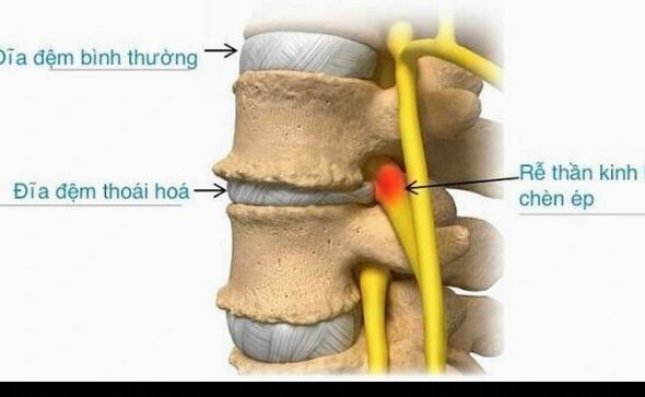 Screenshot_20260324-095913~2